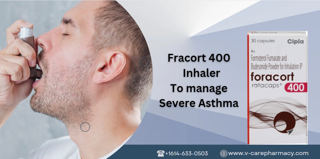 How to manage severe asthma?